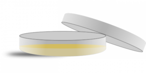 Gör mögeltest för att ta reda på om bostaden drabbats av svartmögel